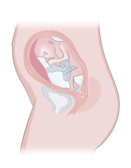 Semana24
